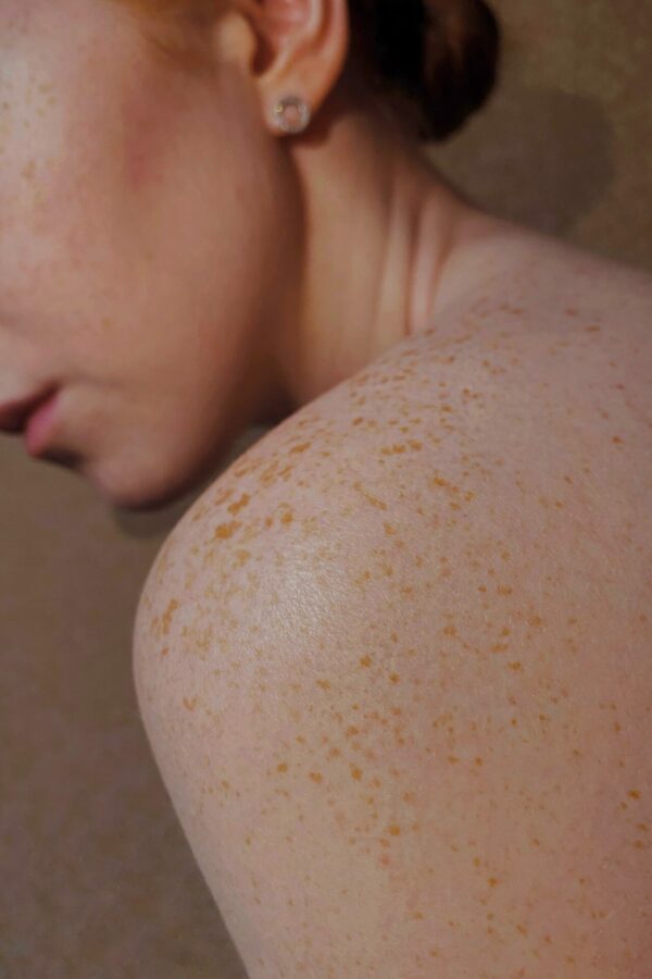 plet 2