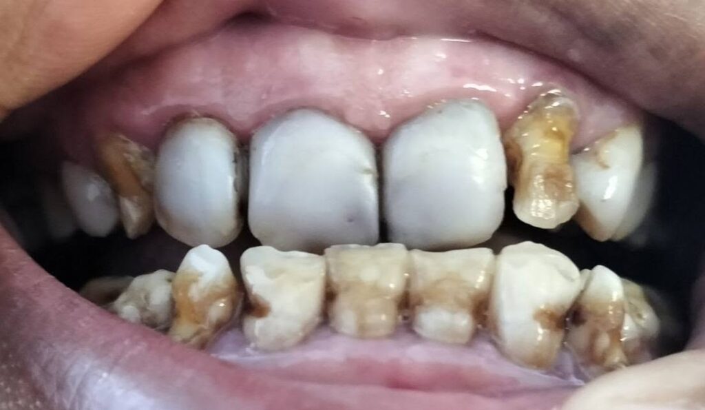 adri 6