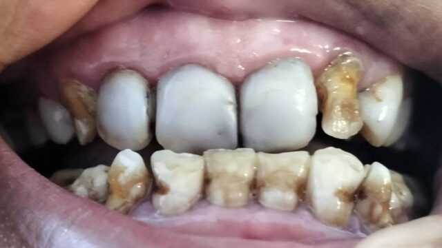 adri 6